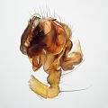 linker Pedipalpus - retrolateral