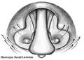 Epigyne
