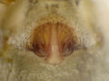 Epigyne