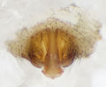 Epigyne freipräpariert