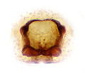 Epigyne (präpariert)