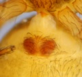 Epigyne