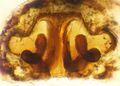 Vulva dorsal