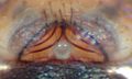 Epigyne