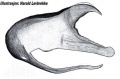 Embolus