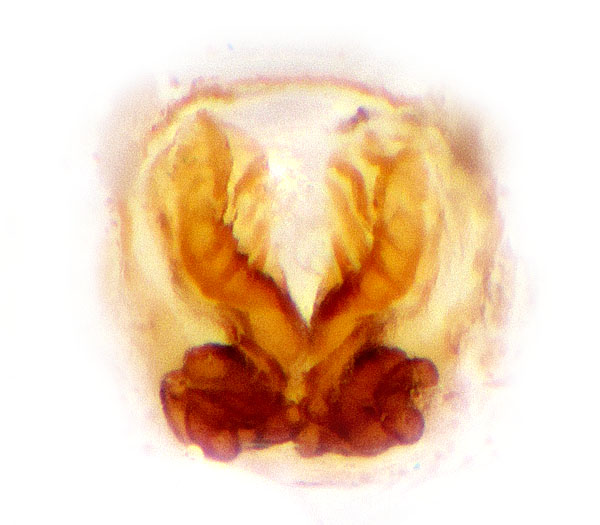 Datei:Ballus chalybeius Vulva Schaefer.jpg