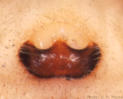 Datei:Evarcha arcuata epigyne 400 GHMorka.jpg