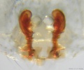 Vulva