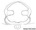 Epigyne