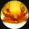 Vulva