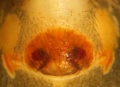 Epigyne